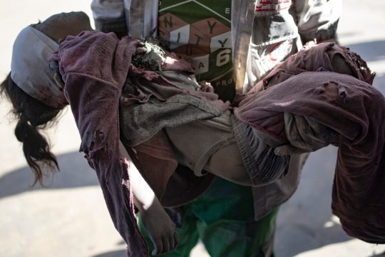 Τραυματισμένο παιδί μεταφέρεται στο νοσοκομείο στο Χαν Γιουνίς